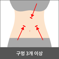 3개 이상 작은 구멍 필요