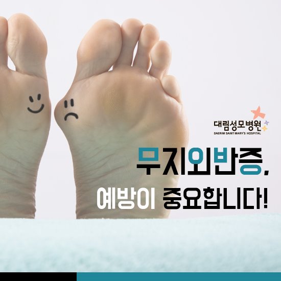[척추관절센터] 무지외반증 1.jpg