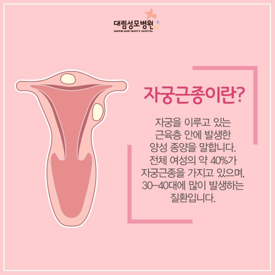 [산부인과] 자궁근종 2.jpg