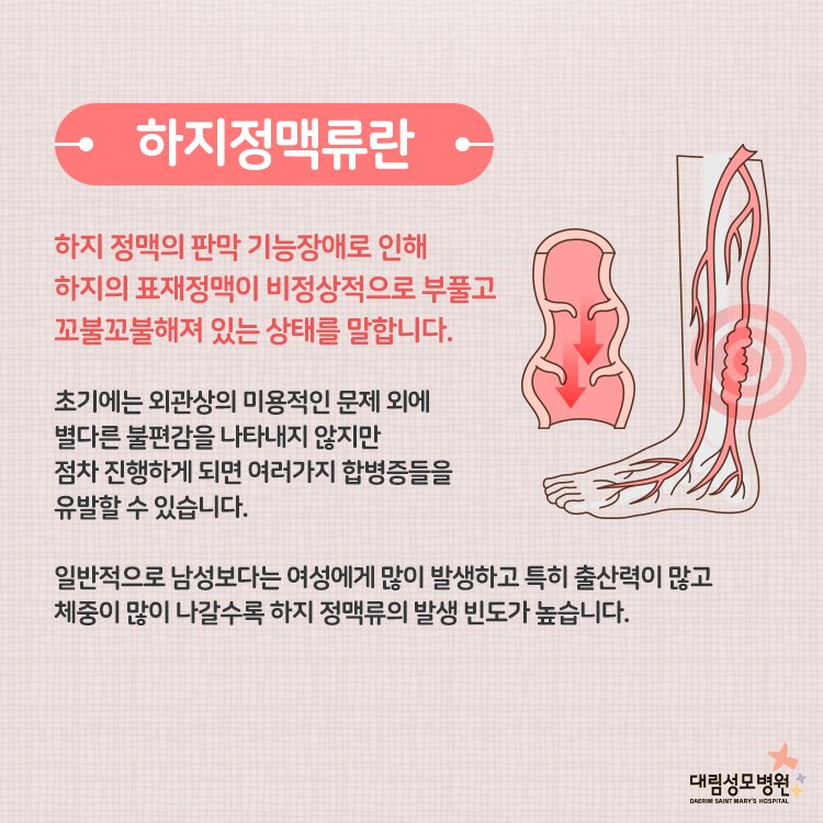 [외과] 하지정맥류 2.jpg