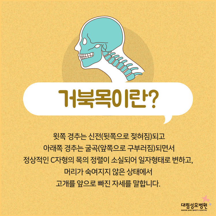 [척추관절센터] 거북목 치료방법 2.jpg