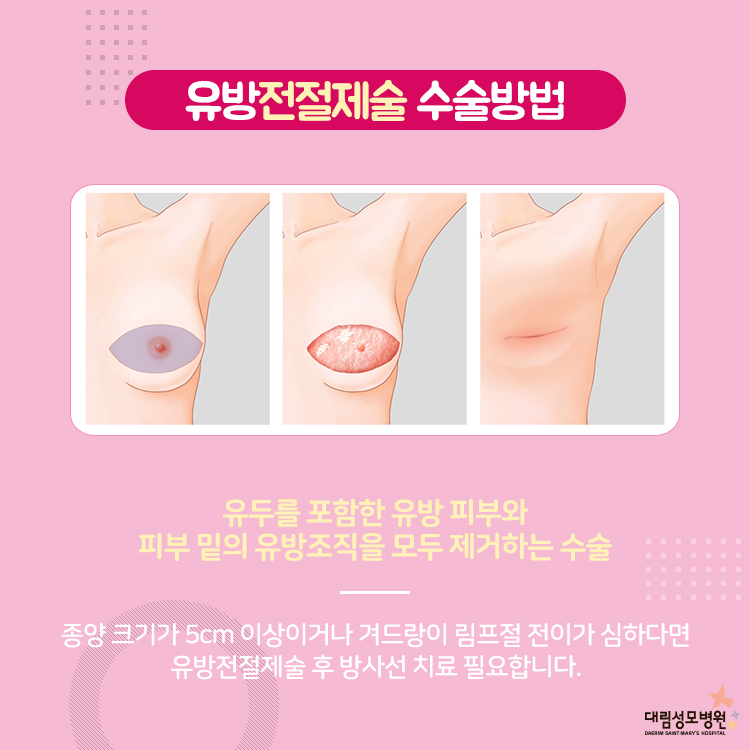 [유방센터] 유방암 수술 4.jpg