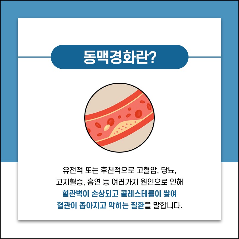 230529_동맥경화_02.jpg