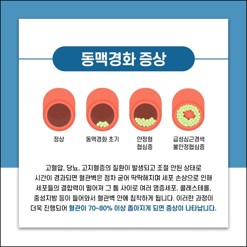 230529_동맥경화_04.jpg