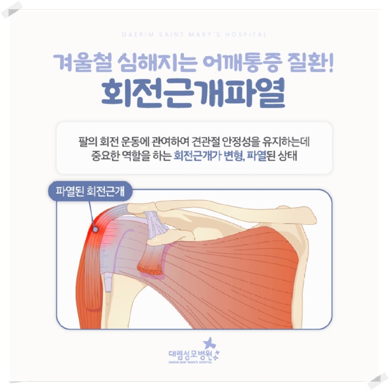 250114_대림성모병원_바이럴_회전근개파열_(3).jpg