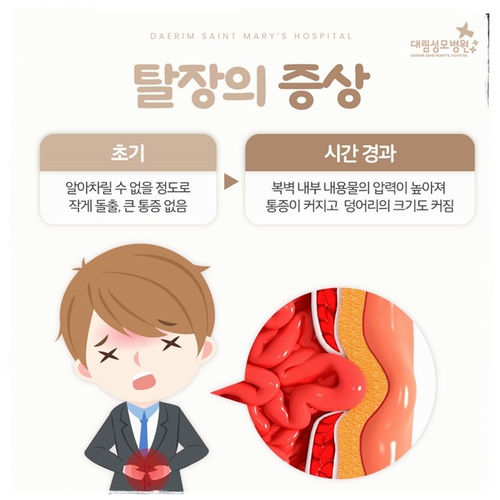 250117_대림성모병원_바이럴_탈장질환_(6).jpg