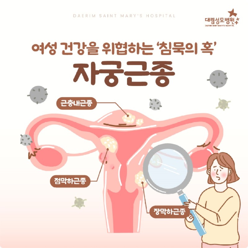 251031_대림성모병원_바이럴_자궁근종_(1).jpg