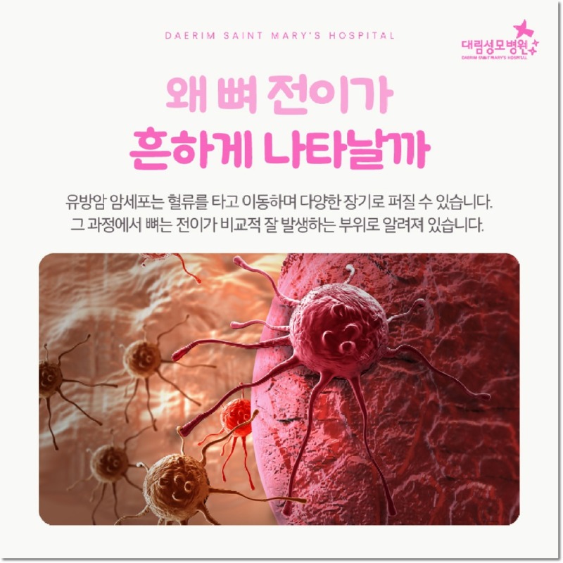 251202_대림성모병원_바이럴_유방암뼈전이_(2).jpg