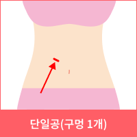 단 1개 절개창(약 2.5cm)