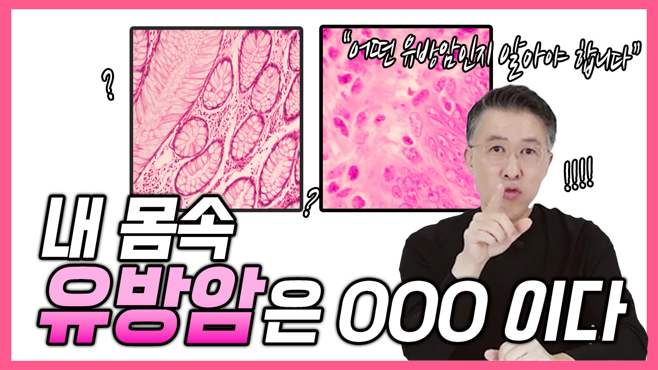 내 유방암은 ㅇㅇㅇ이다!  