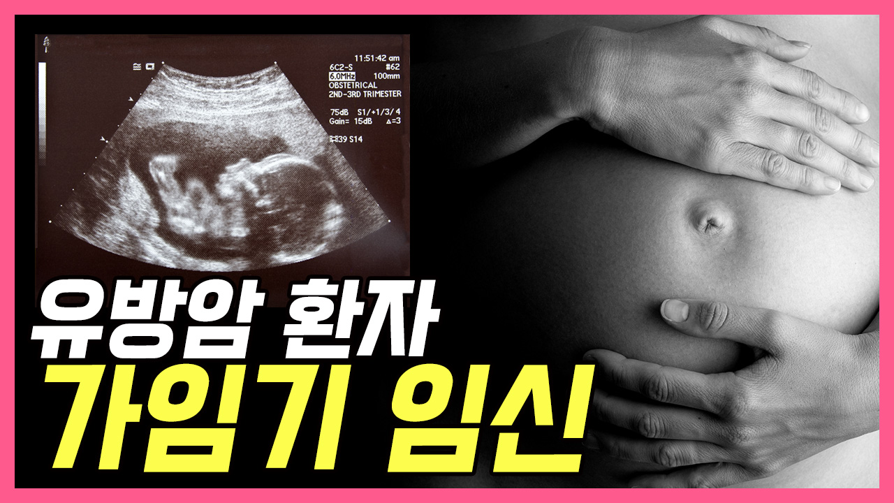 가임기 유방암 환자, 임신해도 될까요  