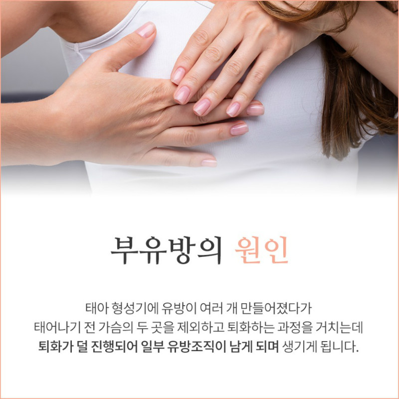 [유방센터] 부유방 3.jpg