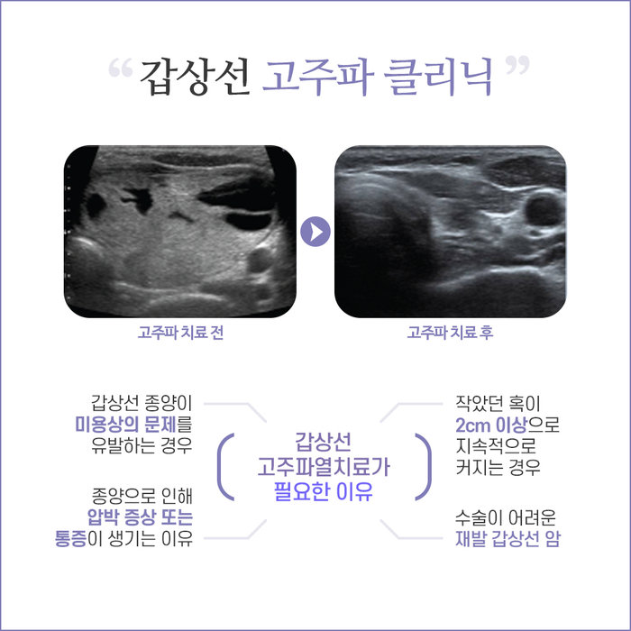 [갑상선센터] 논스톱 다학제 진료 5.jpg